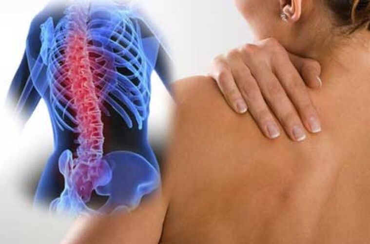 При остеохондроза болката може да се разпространи в отдалечени части на тялото