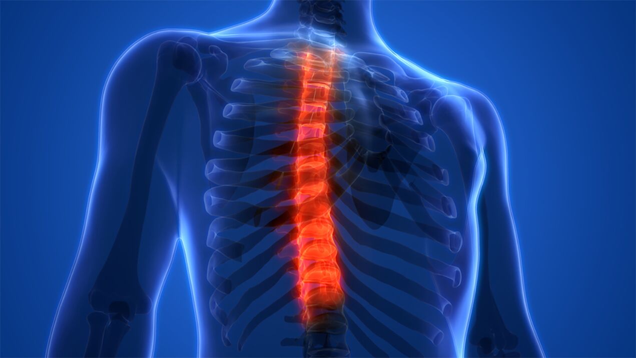 симптоми на гръдна остеохондроза