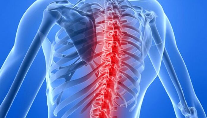Гръбначните патологии са най-честите причини за болки в гърба в областта на лопатките
