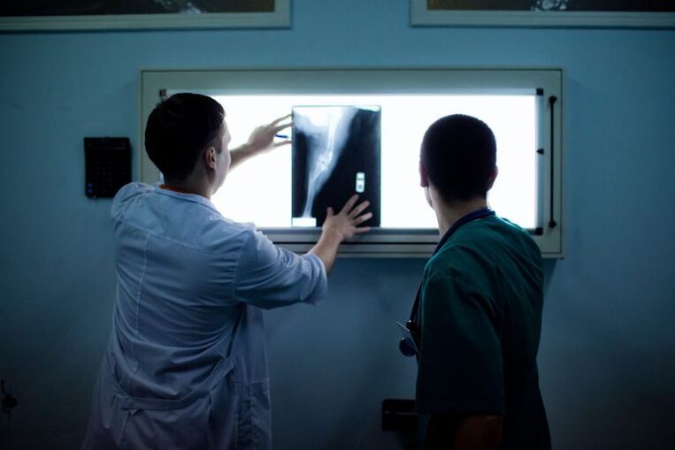 Диагностика на артроза върху X -ray