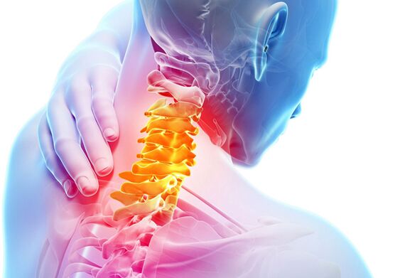 Цервикална остеохондроза